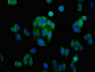 AKR1C1 Antibody