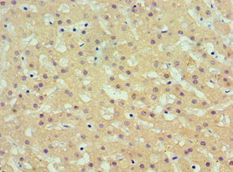 AKR1C4 Antibody