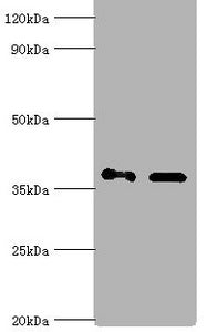 AKR1C4 Antibody