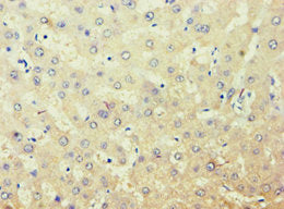 AKR7A3 Antibody