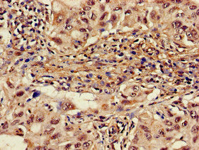 ALAS1 Antibody