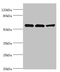 ALDH1B1 Antibody