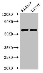 ALDH6A1 Antibody