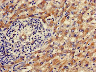 ALDH9A1 Antibody