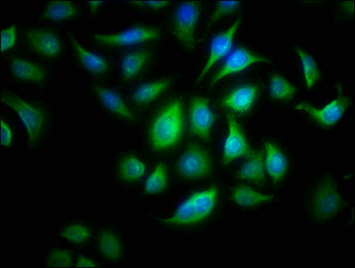 ALOX15B Antibody