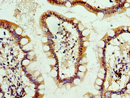 ALPL Antibody