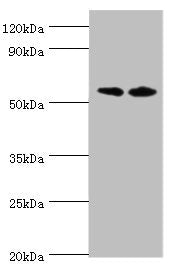 ALPP Antibody