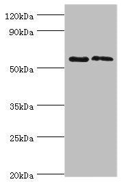 ALPP Antibody