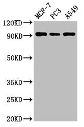 AMPD1 Antibody