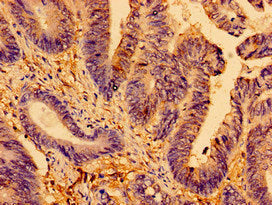 AMPD2 Antibody