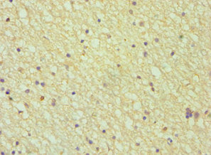 AMPH Antibody