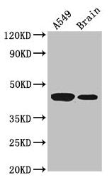 AMT Antibody