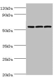 AMY2B Antibody