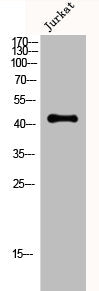 CKM Antibody