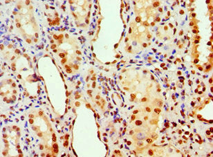 ANP32A Antibody