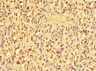 ANP32D Antibody