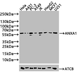 ANXA11 Antibody