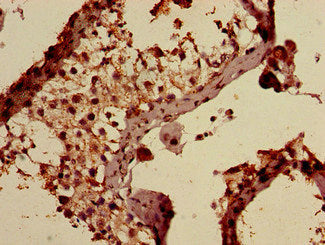 AP1S3 Antibody, Biotin conjugated