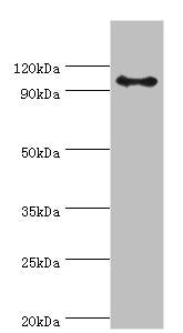 AP2B1 Antibody