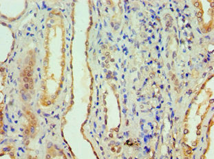 APCS Antibody