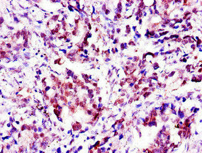 APTX Antibody