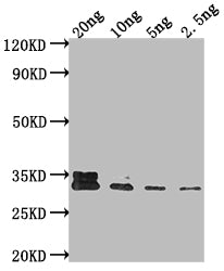 AR Antibody