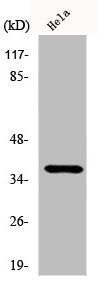 CYSLTR2 Antibody