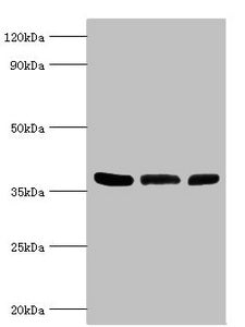 ARG2 Antibody