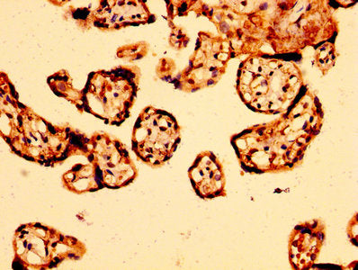ARHGEF11 Antibody