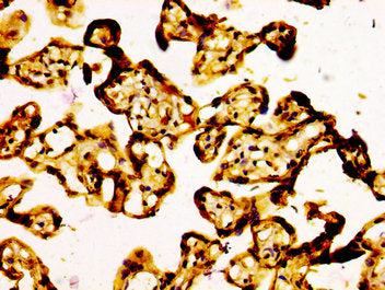ARID1A Antibody