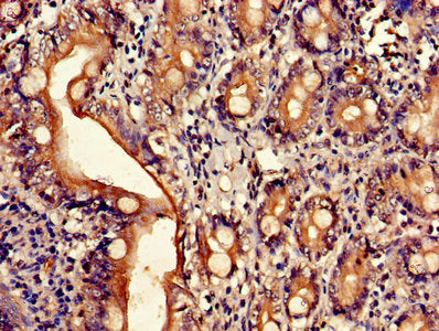 ARL4D Antibody