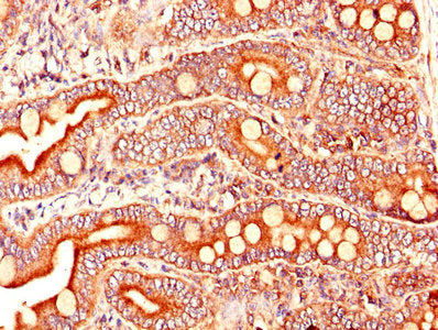 ARL6IP5 Antibody
