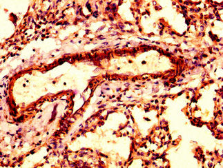 ARPC4 Antibody