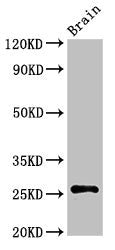 ASCL1 Antibody