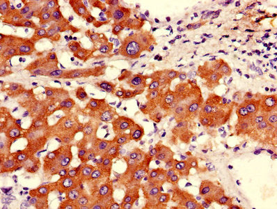 ASGR2 Antibody