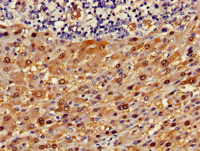 ASL Antibody