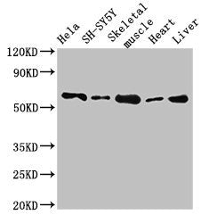 ASNS Antibody