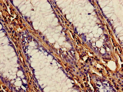 CSTB Antibody