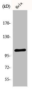 EEF2K Antibody