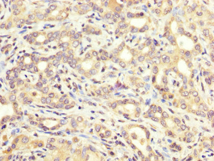 ATE1 Antibody