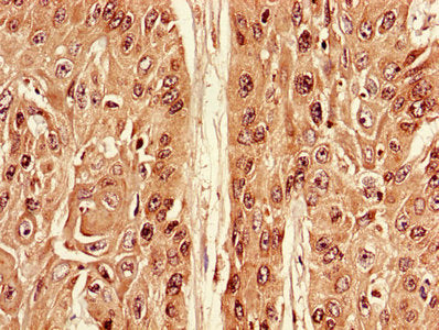 ATG7 Antibody