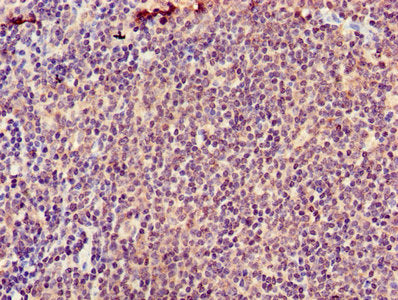 ATIC Antibody
