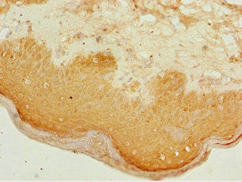 ATMIN Antibody