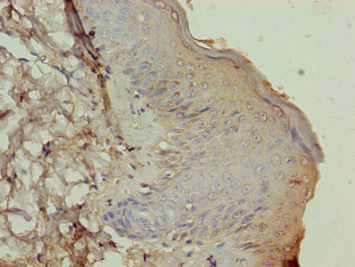 ATP12A Antibody