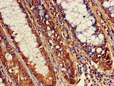 ATP1B3 Antibody