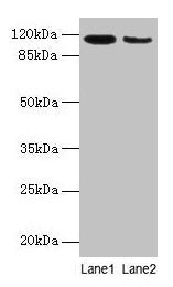 ATP2A2 Antibody