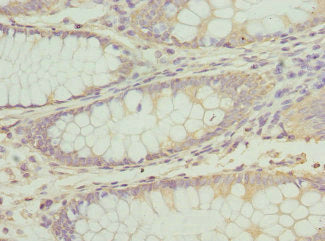 ATP2B2 Antibody