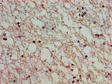 ATP2C1 Antibody