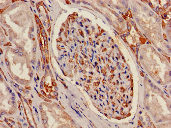 ATP5F1C Antibody