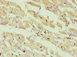ATP5O Antibody